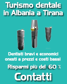 Estetica dentale donna economico bravo onesto low cost clinica dentale a prezzi bassi