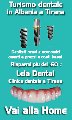 dentisti-in-Albania-pagamenti-per-cure-dentali