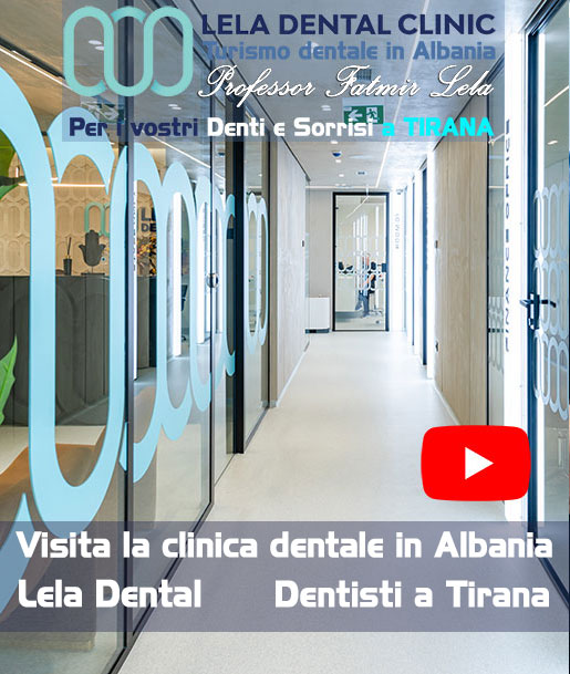 Clinica-dentale-a-Tirana-Albania-lela-dental