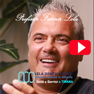 recensione-Gianluca-Lela-dental