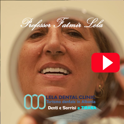 recensione-Carla-Lela-dental