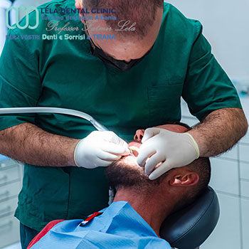 Dentista-Albania-a-Tirana-nella-clinica-Lela-Dental-9