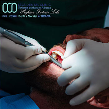 Dentista-Albania-a-Tirana-nella-clinica-Lela-Dental-14