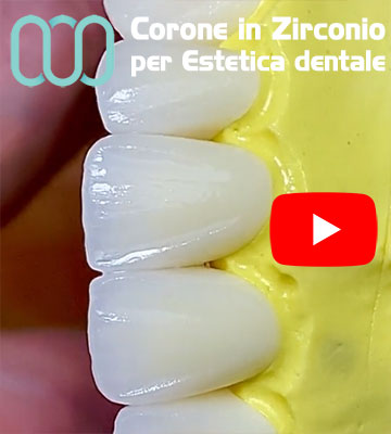 corone-in-zirconio-per-estetica-dentale-Albania-Tirana