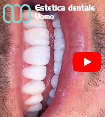 estetica-dentale-Uomo-Albania-Tirana